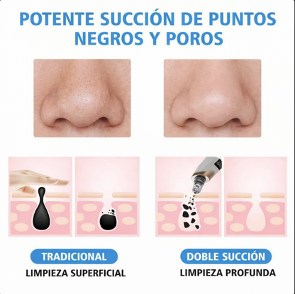 Removedor de Puntos Negros Por Succion