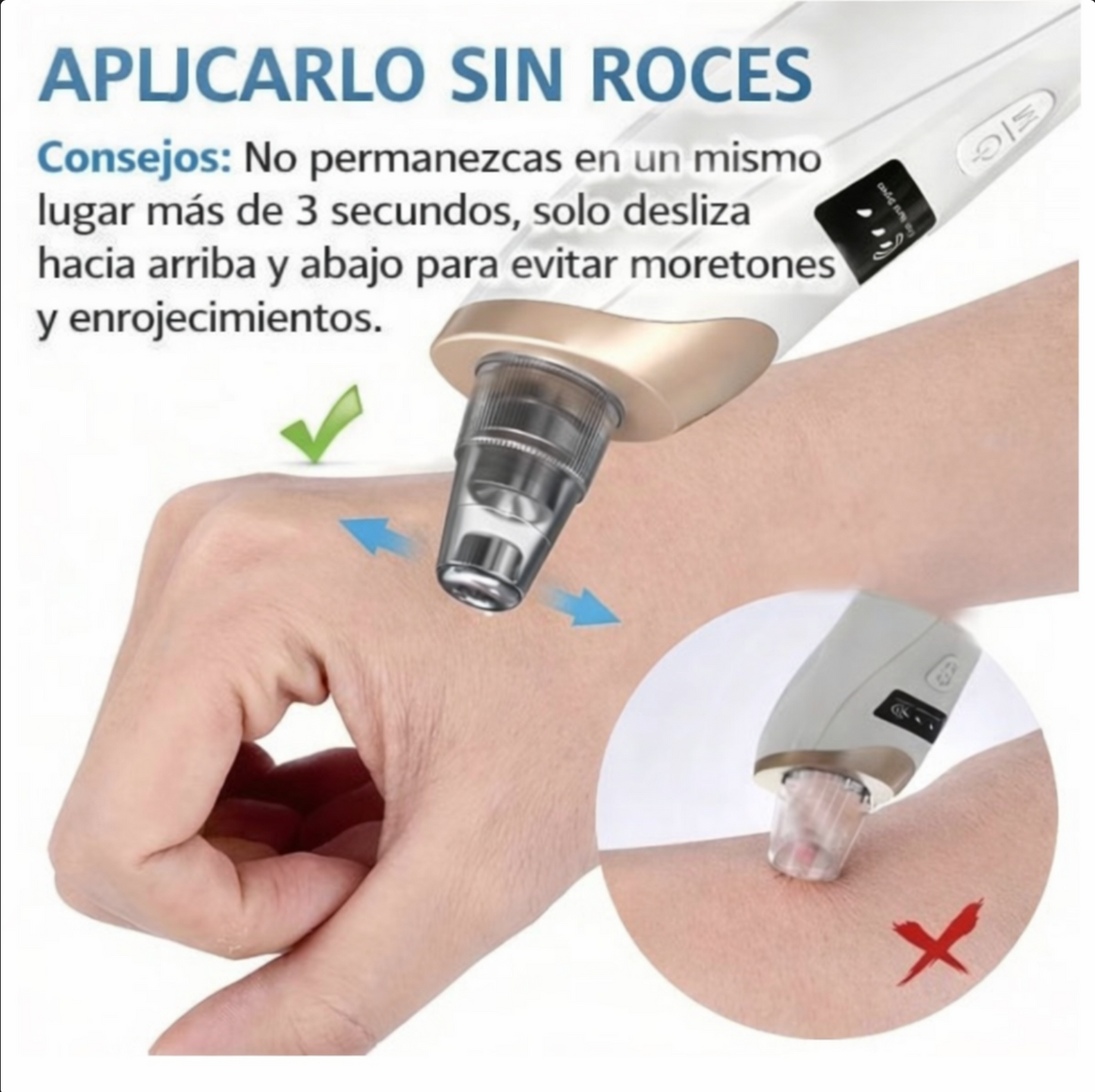 Removedor de Puntos Negros Por Succion