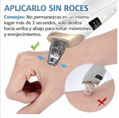 Removedor de Puntos Negros Por Succion