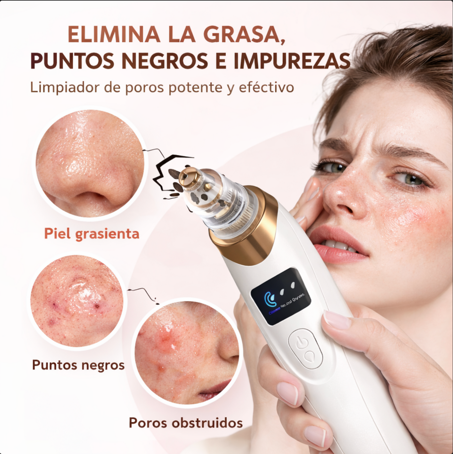 Removedor de Puntos Negros Por Succion