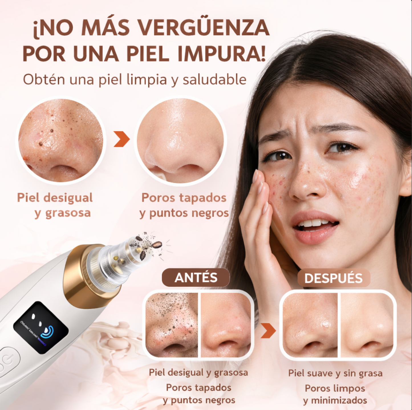 Removedor de Puntos Negros Por Succion
