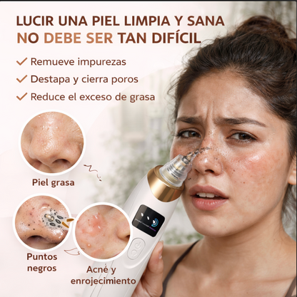 Removedor de Puntos Negros Por Succion